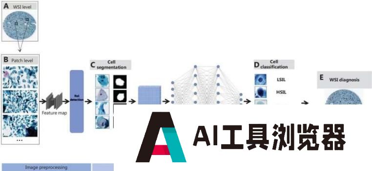 AI软件通过医学图像识别并提高宫颈癌的精准检测率